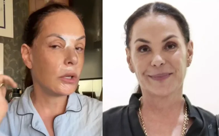 Aos 58 anos, Carolina Ferraz revela o ‘botox natural’ por trás da pele de porcelana