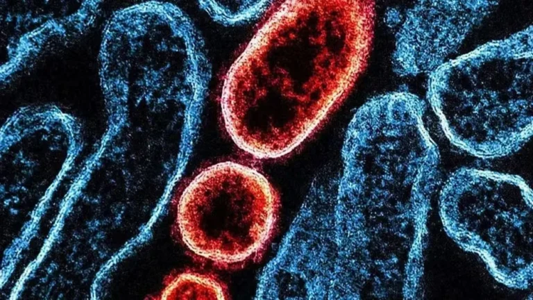 Surto de Nipah no Carnaval? Entenda se há risco para o Brasil e quais os sintomas da doença