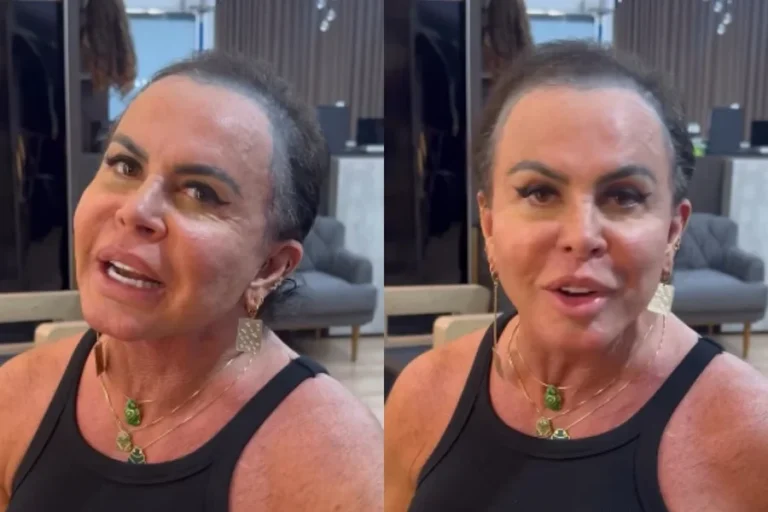 Gretchen aparece sem prótese capilar e revela destino de cabelo