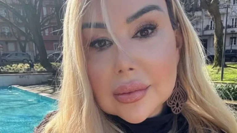 Patrícia Ribeiro expõe agressão de ex-parceiro: Quebrou cadeira em mim