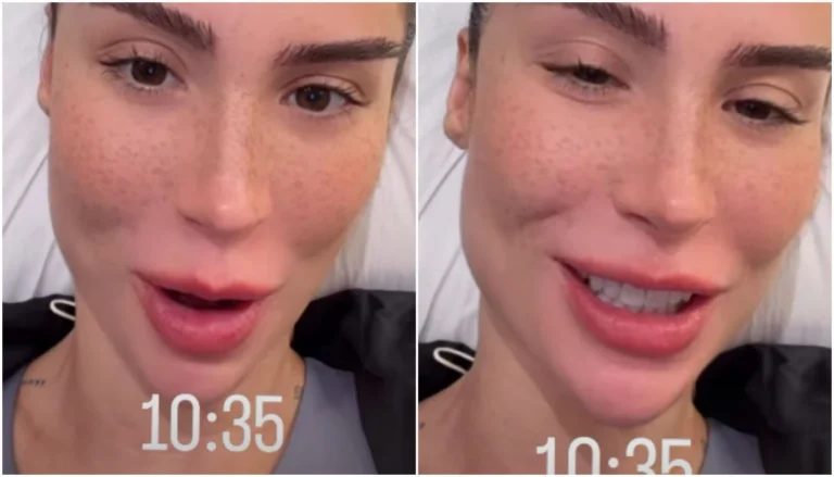Bianca Andrade conta detalhe do transplante de sobrancelha: “Não assustem”