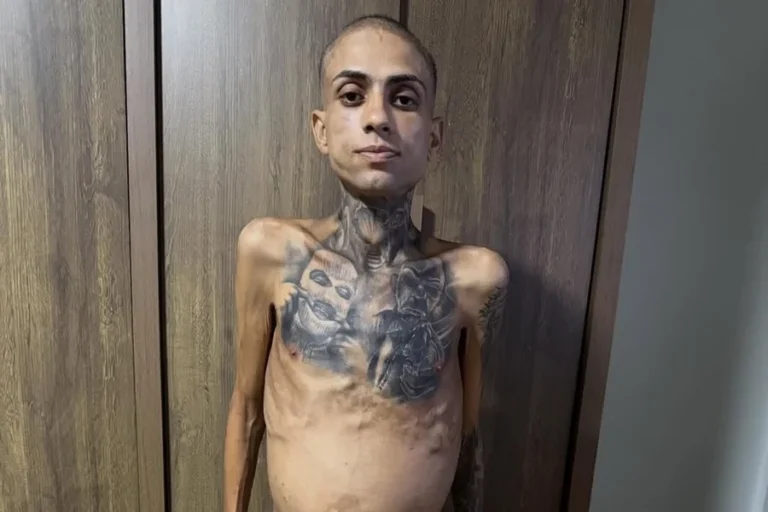 Influenciador Jota Surfista morre após diagnóstico de câncer