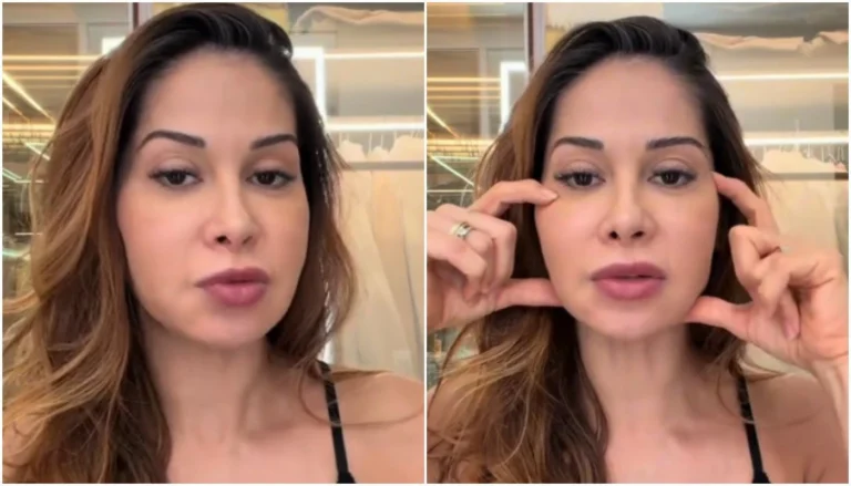 Maíra Cardi conta que fará cirurgia delicada após deformação no rosto
