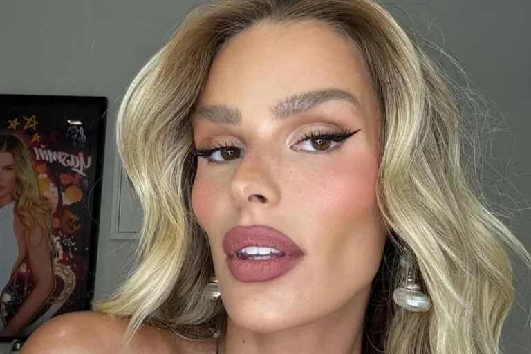 Lipedema: Yasmin Brunet perde 25 kg e mostra antes e depois; veja