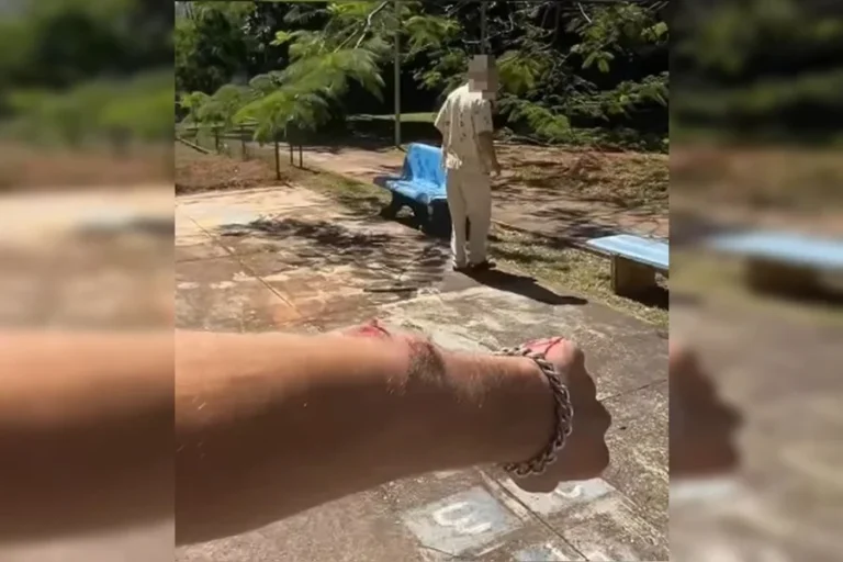 Homem relata agressão e braço quebrado após defender mulher no DF. Veja o vídeo
