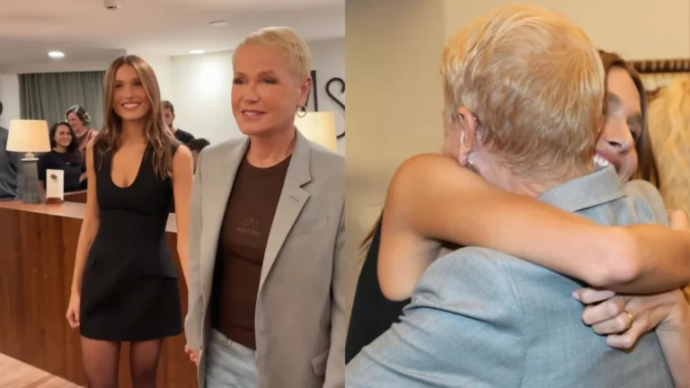 Xuxa comemora resultado de transplante capilar: “Me fazia mal”