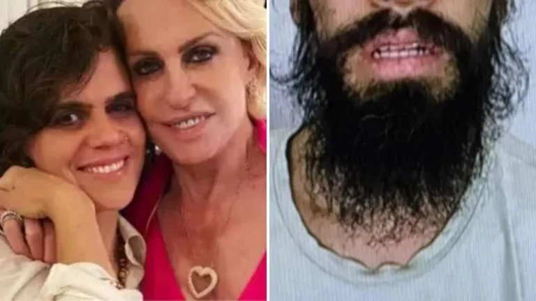 Foto de ex-genro de Ana Maria Braga com marcas de agressão vaza após prisão