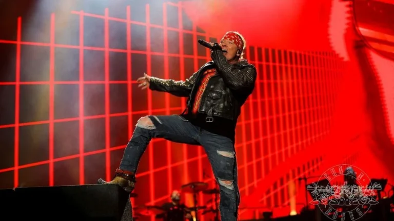 Axl Rose revela problema de saúde “desafiador” e diz que fez cirurgia