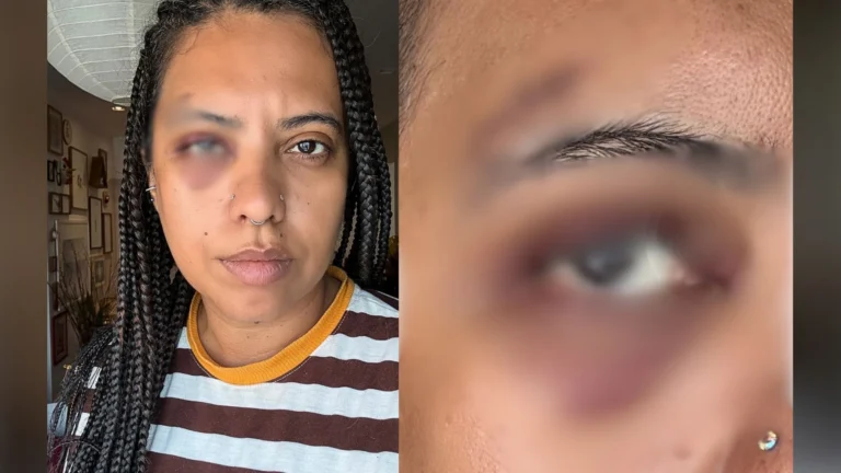 Influenciadora é agredida em samba na região central do Rio de Janeiro