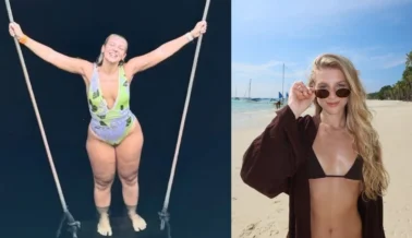 Lauren Pfeiff relata um ano de cirurgia de lipedema: 